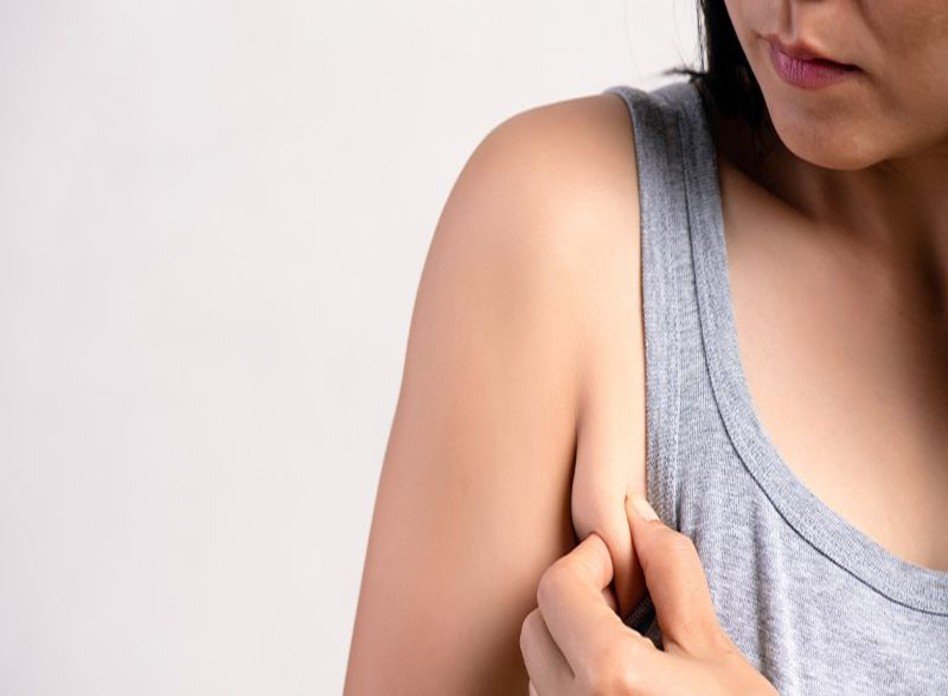 Accessory Breast Removal Axillary