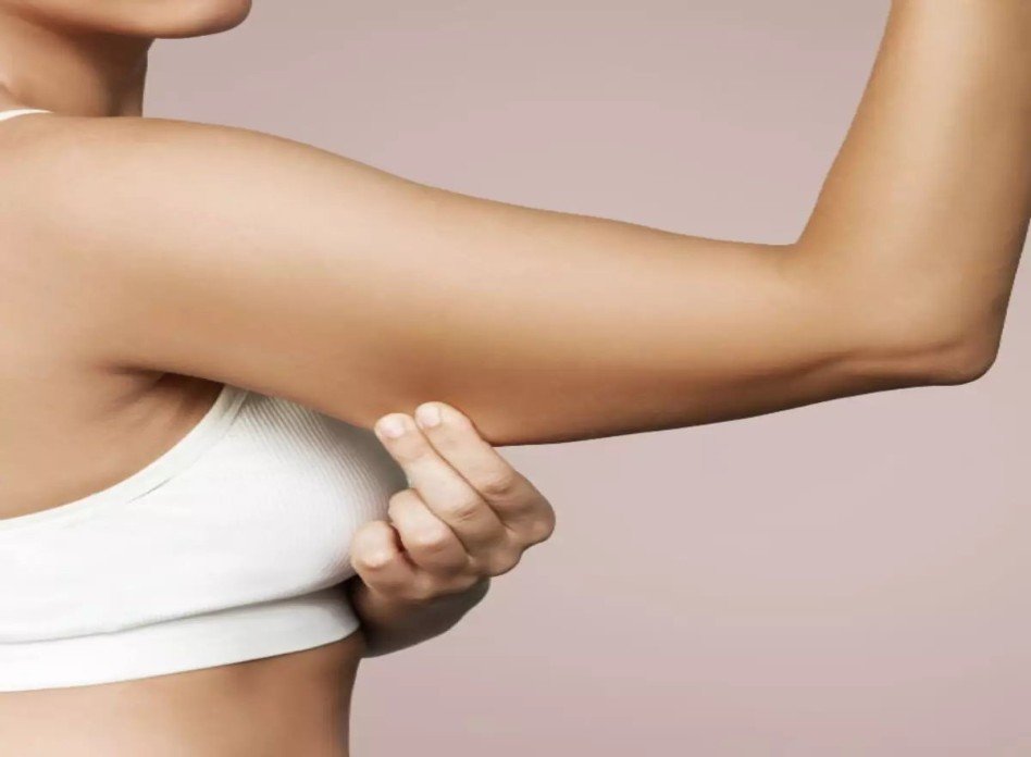 Brachioplasty Arm Lift Surgery