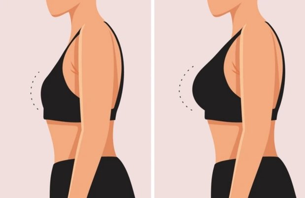 Breast Reconstruction Surgery