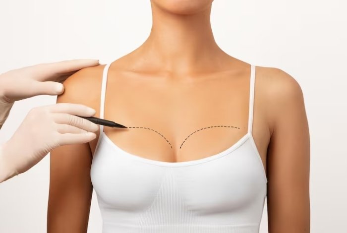 Breast Reconstruction Treatment