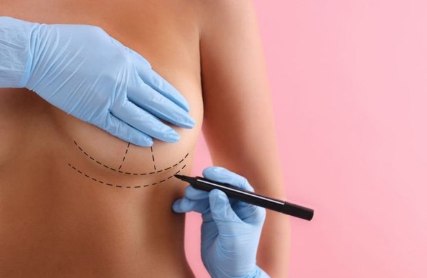 Breast Surgery