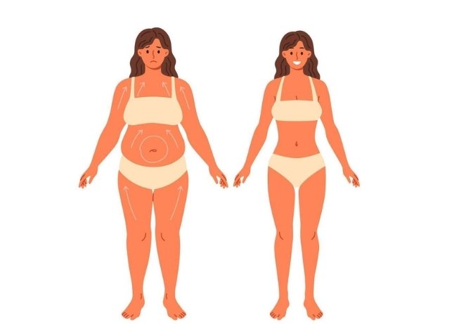Liposuction (Stubborn Fat Removal)