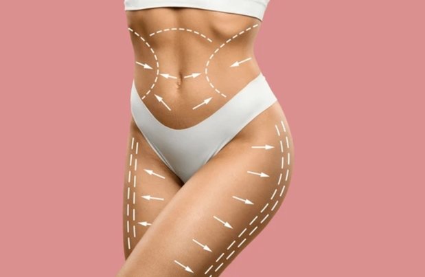 Body Contouring