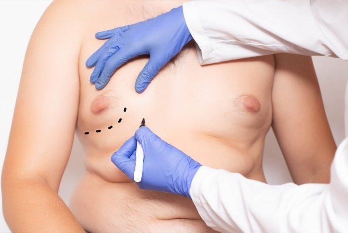 Male Rejuvenation in Mumbai
