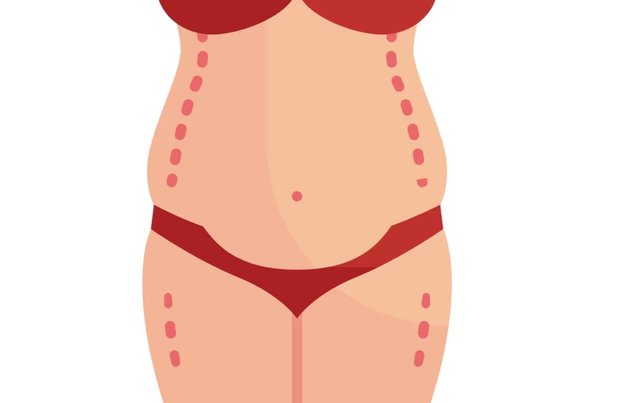 Mommy Makeover Surgery in Mumbai​