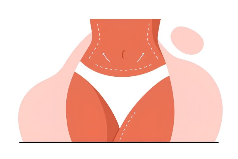 Abdominoplasty (Tummy Tuck) Surgery in Mumbai​