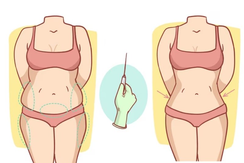 Lipo-Filling / Fat Grafting in Mumbai