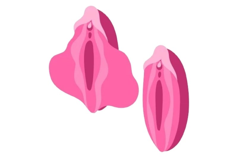 Labiaplasty Surgery in Mumbai​